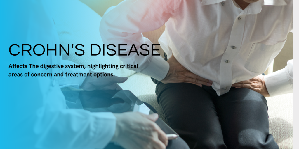 Crohn's Disease Management Tips | Health Search Hub